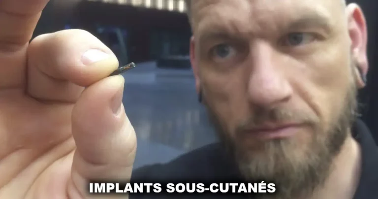 Implants sous cutanés